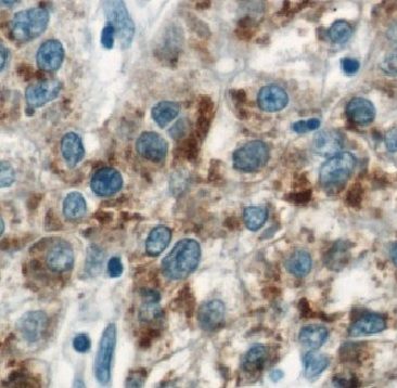 ARL15 Antibody - BSA Free