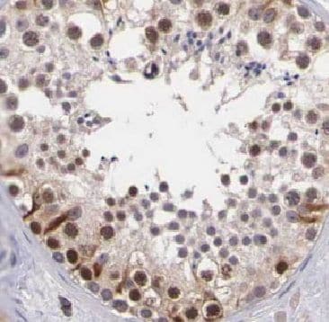 BRCAA1 Antibody - BSA Free