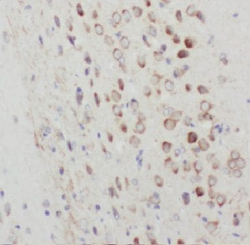 ARHGEF4 Antibody - BSA Free