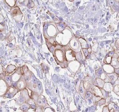 p114RhoGEF Antibody - BSA Free