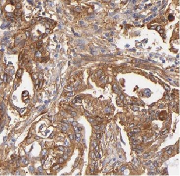 ARHGDIG Antibody - BSA Free