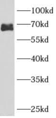 ARHGAP9 Antibody - BSA Free