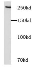 ARHGAP21 Antibody - BSA Free