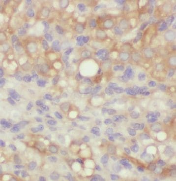 ARHGAP21 Antibody - BSA Free
