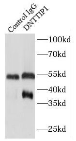 DNTTIP1 Antibody - BSA Free