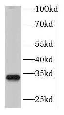 Deoxyribonuclease I like 1 Antibody - BSA Free