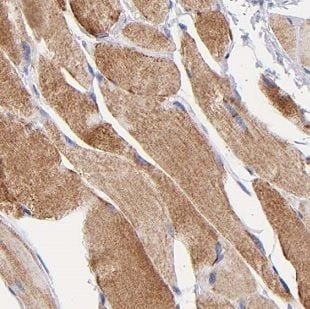 Deoxyribonuclease I like 1 Antibody - BSA Free