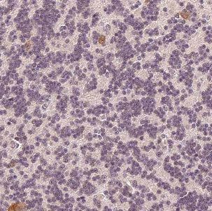 DNAJC6 Antibody - BSA Free