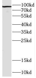 DNAJC16 Antibody - BSA Free