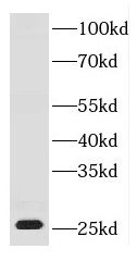 DNAJB8 Antibody - BSA Free