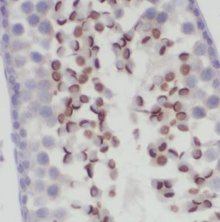DNAJB13 Antibody - BSA Free