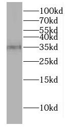 DNAJB13 Antibody - BSA Free