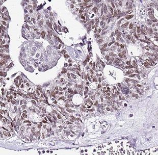 DNAJB11 Antibody - BSA Free