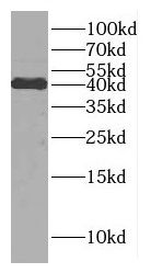 DNAJB11 Antibody - BSA Free