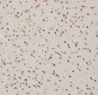 Dynein intermediate chain 2 Antibody - BSA Free