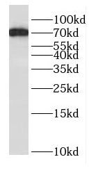 Dynein intermediate chain 2 Antibody - BSA Free