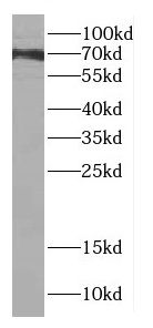dystrophia myotonica containing WD repeat motif Antibody - BSA Free