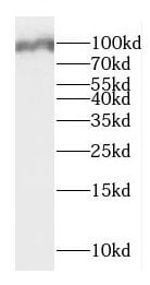 DMGDH Antibody - BSA Free
