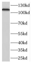 DLGAP3 Antibody - BSA Free