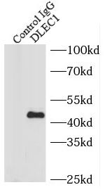 DLC1/DLEC1 Antibody - BSA Free