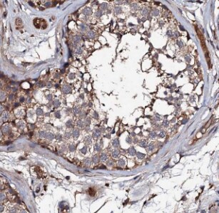 DLC1/DLEC1 Antibody - BSA Free
