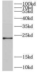 DIRAS2 Antibody - BSA Free