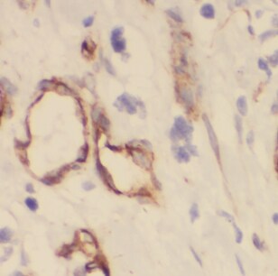 DIRAS1 Antibody - BSA Free