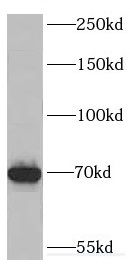 DHX35 Antibody - BSA Free