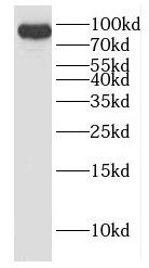 DHX15 Antibody - BSA Free