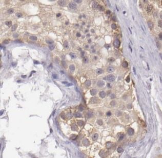 DGKH Antibody - BSA Free