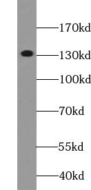 DGKH Antibody - BSA Free