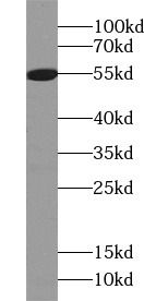 Dfna5 Antibody - BSA Free