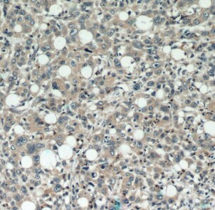 DEFB121 Antibody - BSA Free