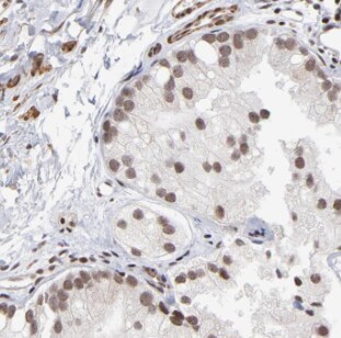 DDX28 Antibody - BSA Free