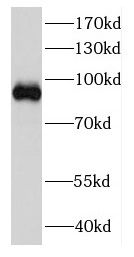 DDX27 Antibody - BSA Free