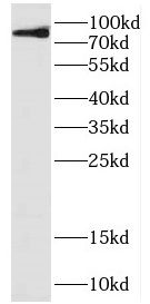 DDHD2 Antibody - BSA Free