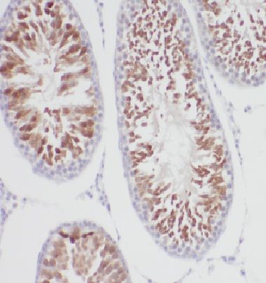 Dynactin 6 Antibody - BSA Free