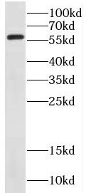 DCLRE1B Antibody - BSA Free