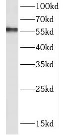 Deleted in azoospermia 4 Antibody - BSA Free