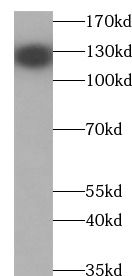 DAB2IP Antibody - BSA Free