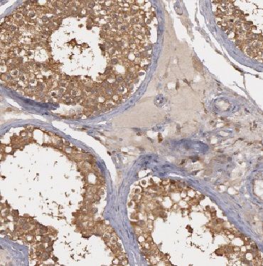 CYTL1 Antibody - BSA Free