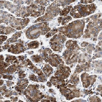 CYP7B1 Antibody - BSA Free