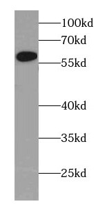 CYP4Z1 Antibody - BSA Free