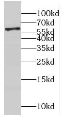 CYP4F12 Antibody - BSA Free