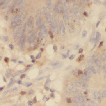 CYP4F12 Antibody - BSA Free