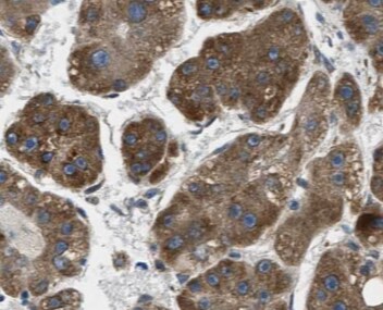 Cytochrome P450 4F11 Antibody - BSA Free