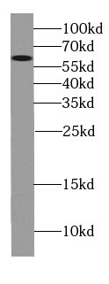 Cytochrome P450 4F11 Antibody - BSA Free