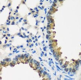 CYP2F1 Antibody - BSA Free