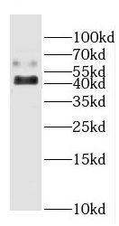CYP20A1 Antibody - BSA Free