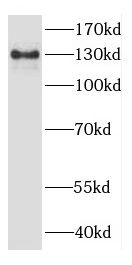 CYFIP2 Antibody - BSA Free